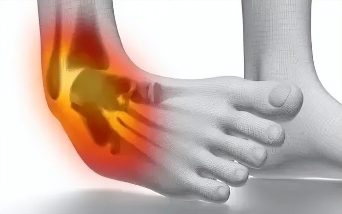 Ankle Sprain Treatment Singapore