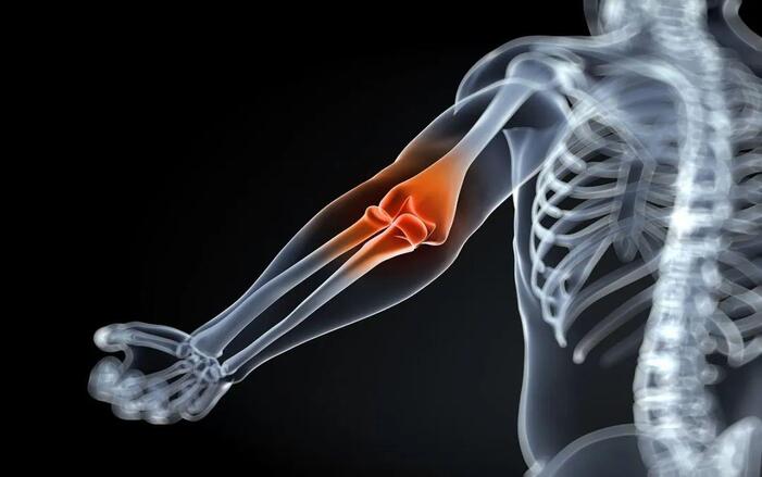 Tennis Elbow Treatment