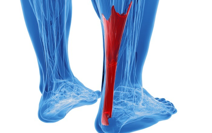 Achilles Tendonitis